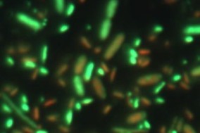 profiilibakut400x400